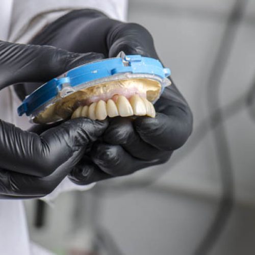 Dental technician holding a monolithic zirconia restorations full arch implant  supported with the ceramic load in vestibular.
