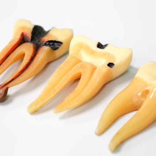 Tooth model for education in laboratory.